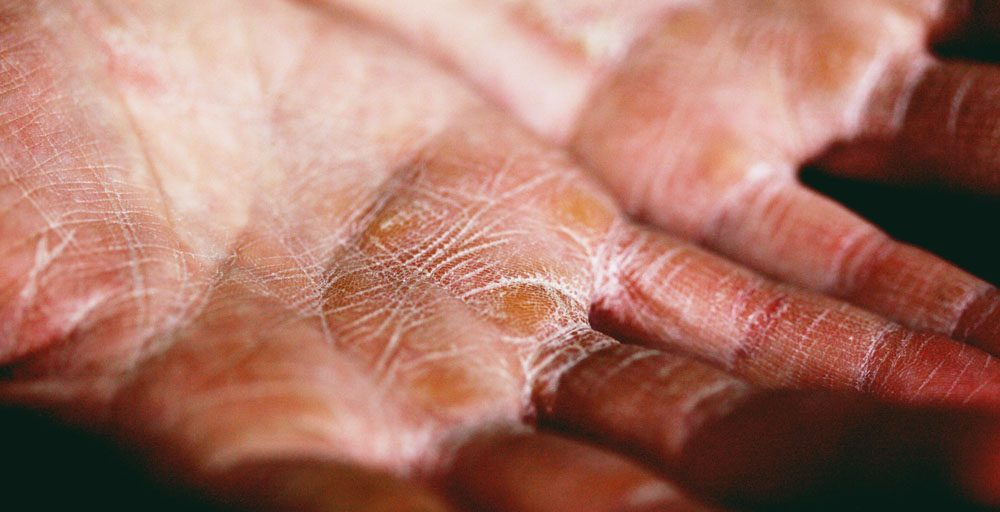 Water evaporates from our skin as we age.