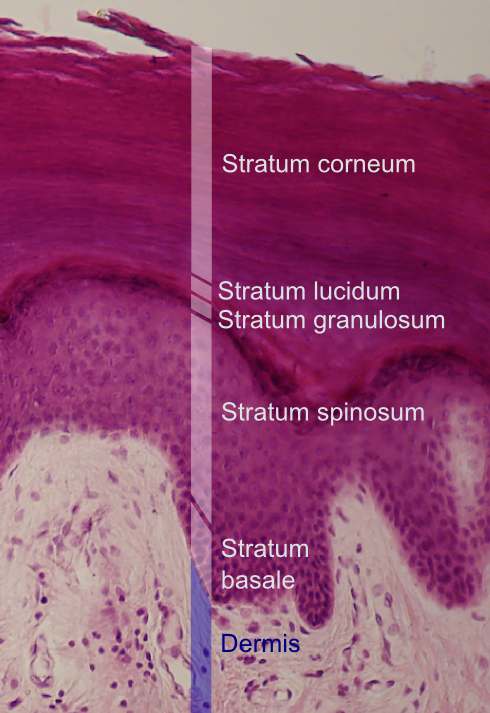 The outermost layer of the epidermis: stratum corneum.
